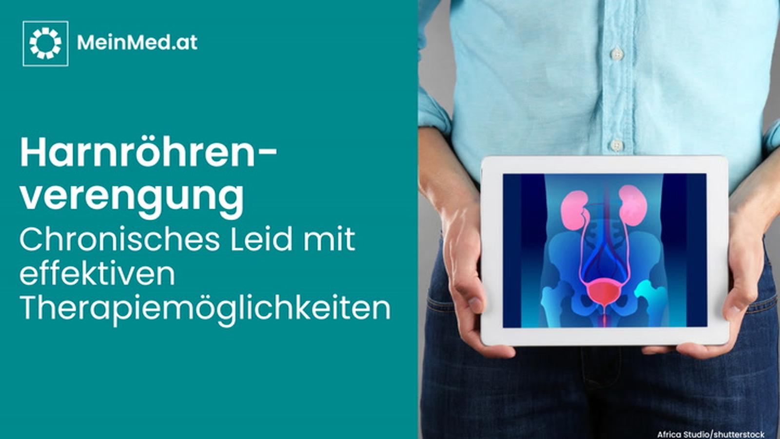 Harnröhrenverengung: Chronisches Leid mit effektiven Therapiemöglichkeiten