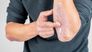 Das Wichtigste zu Psoriasis während der Pandemie