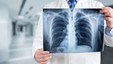 Arzt hält ein Röntgenbild vom Oberkörper