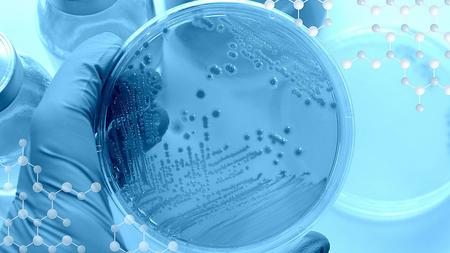 Forscher untersuchen Bakterien in einer Petrischale