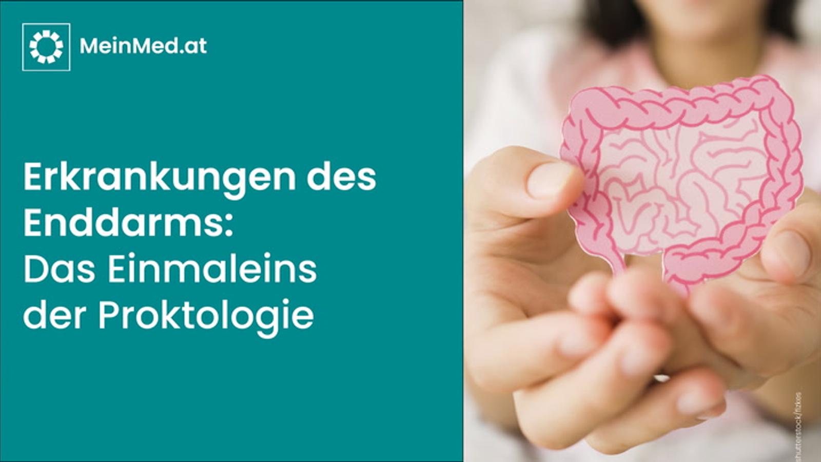 Erkrankungen des Enddarms: Das Einmaleins der Proktologie