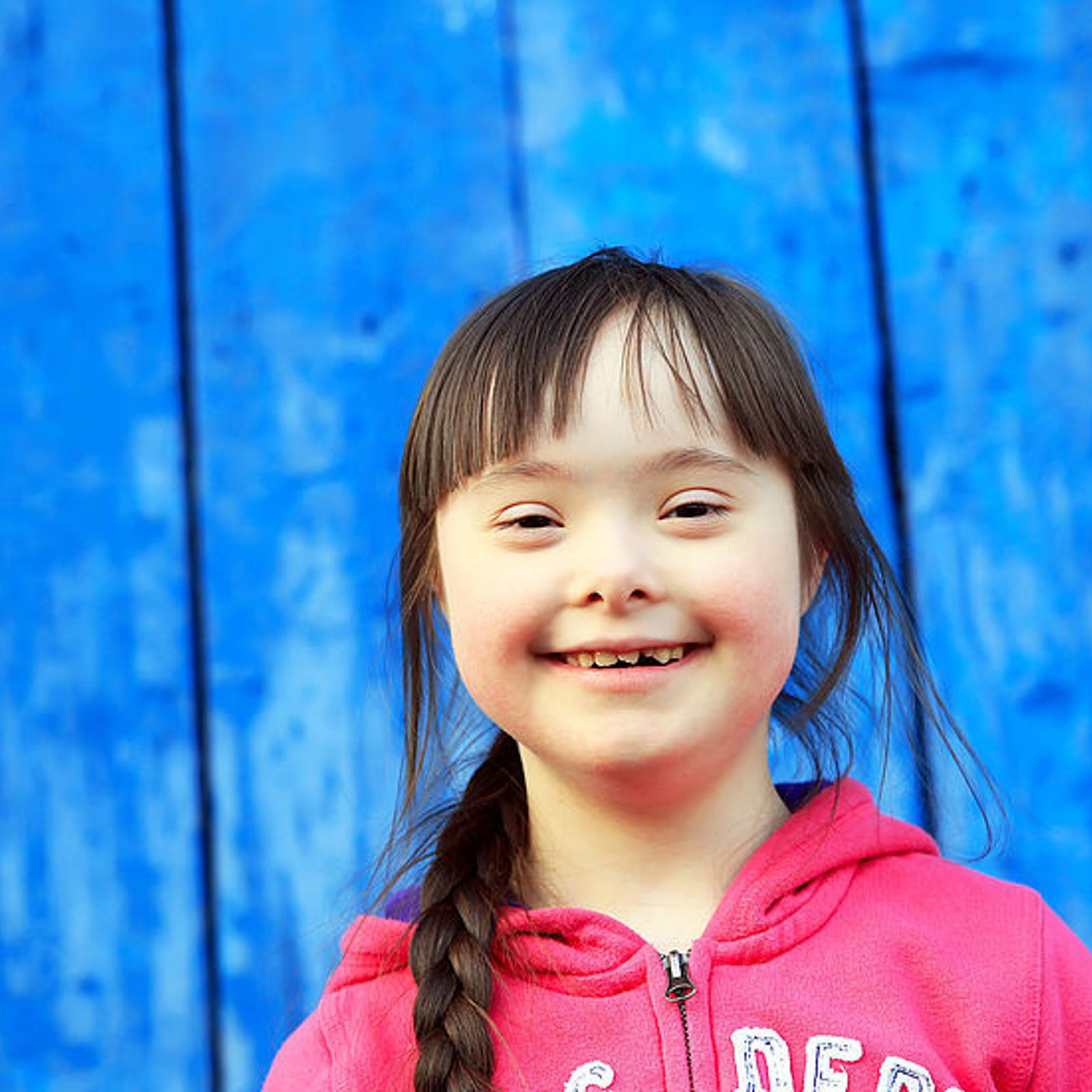 Antwort Wie kann man DownSyndrom vorbeugen? Weitere Antworten Was erhöht das Risiko ein Kind