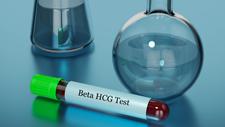 Das Hormon Beta-hCG kann durch sowohl im Blut als auch im Urin nachgewiseen werden