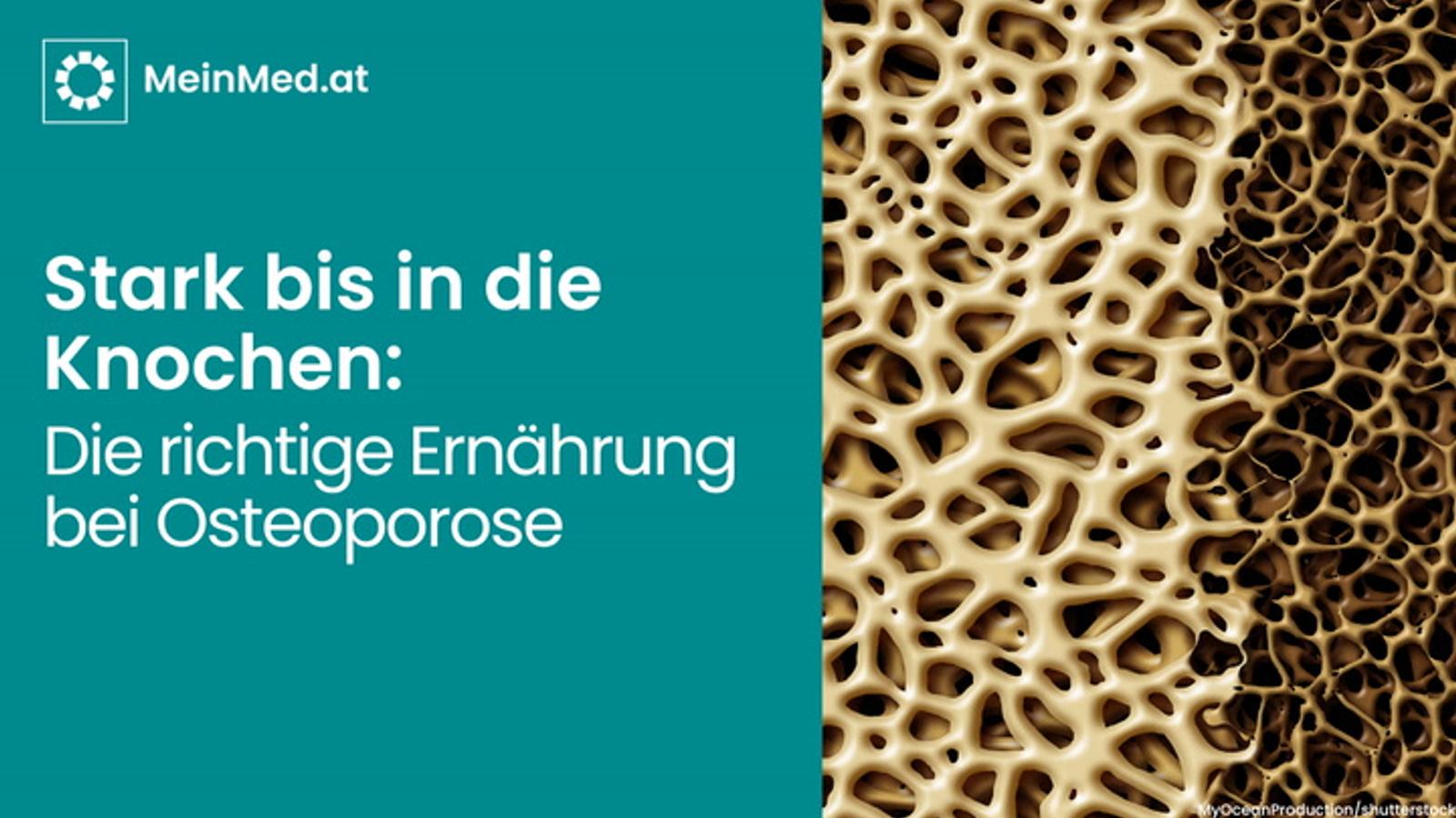 Stark bis in die Knochen: Die richtige Ernährung bei Osteoporose