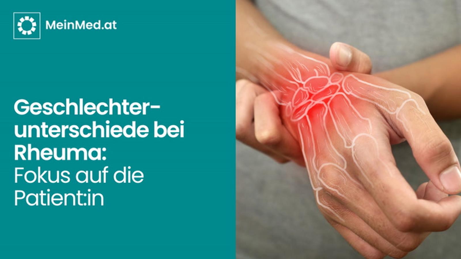 Geschlechterunterschiede bei Rheuma: Fokus auf die Patient:in