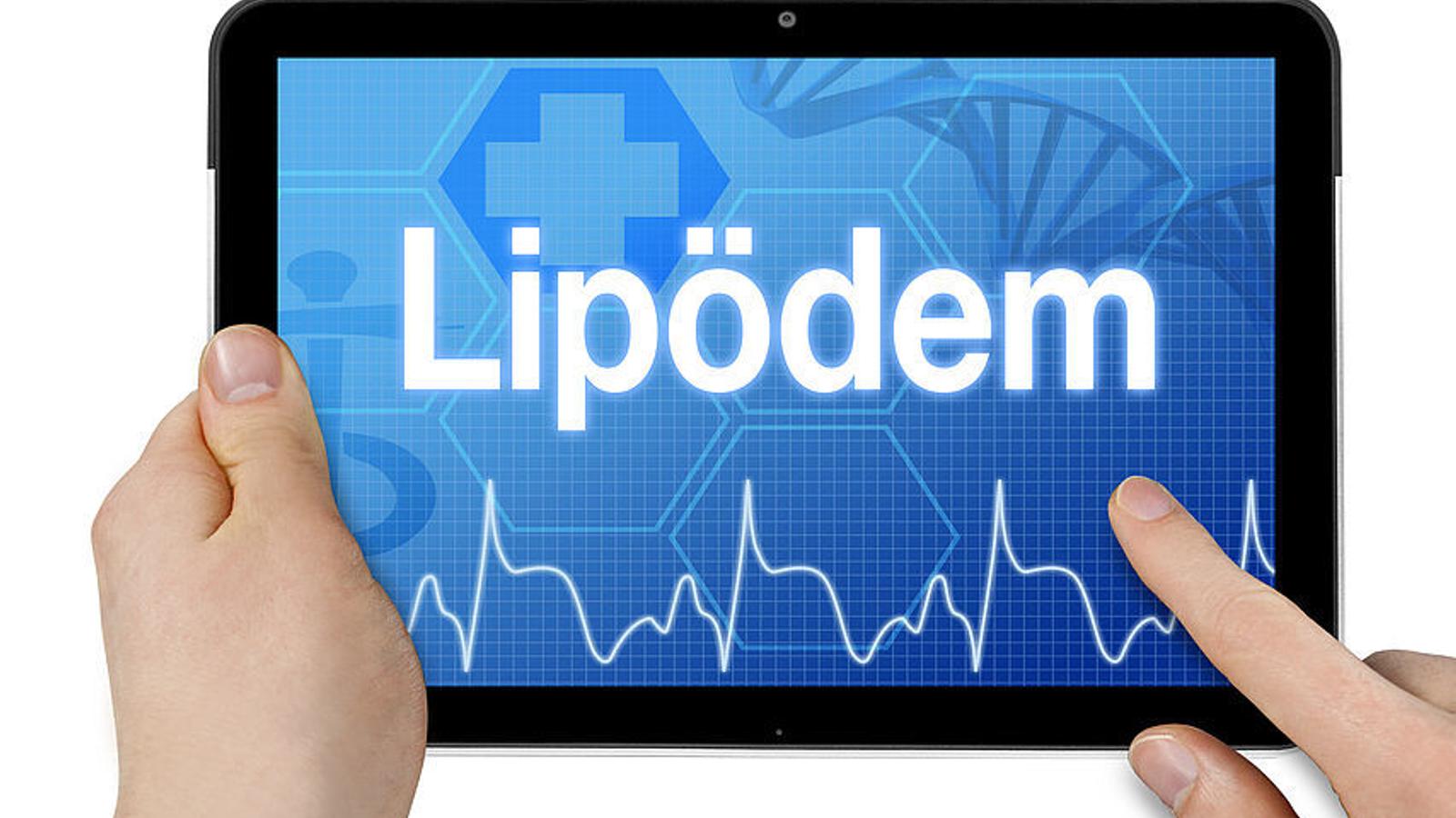 Diagnose Lipödem