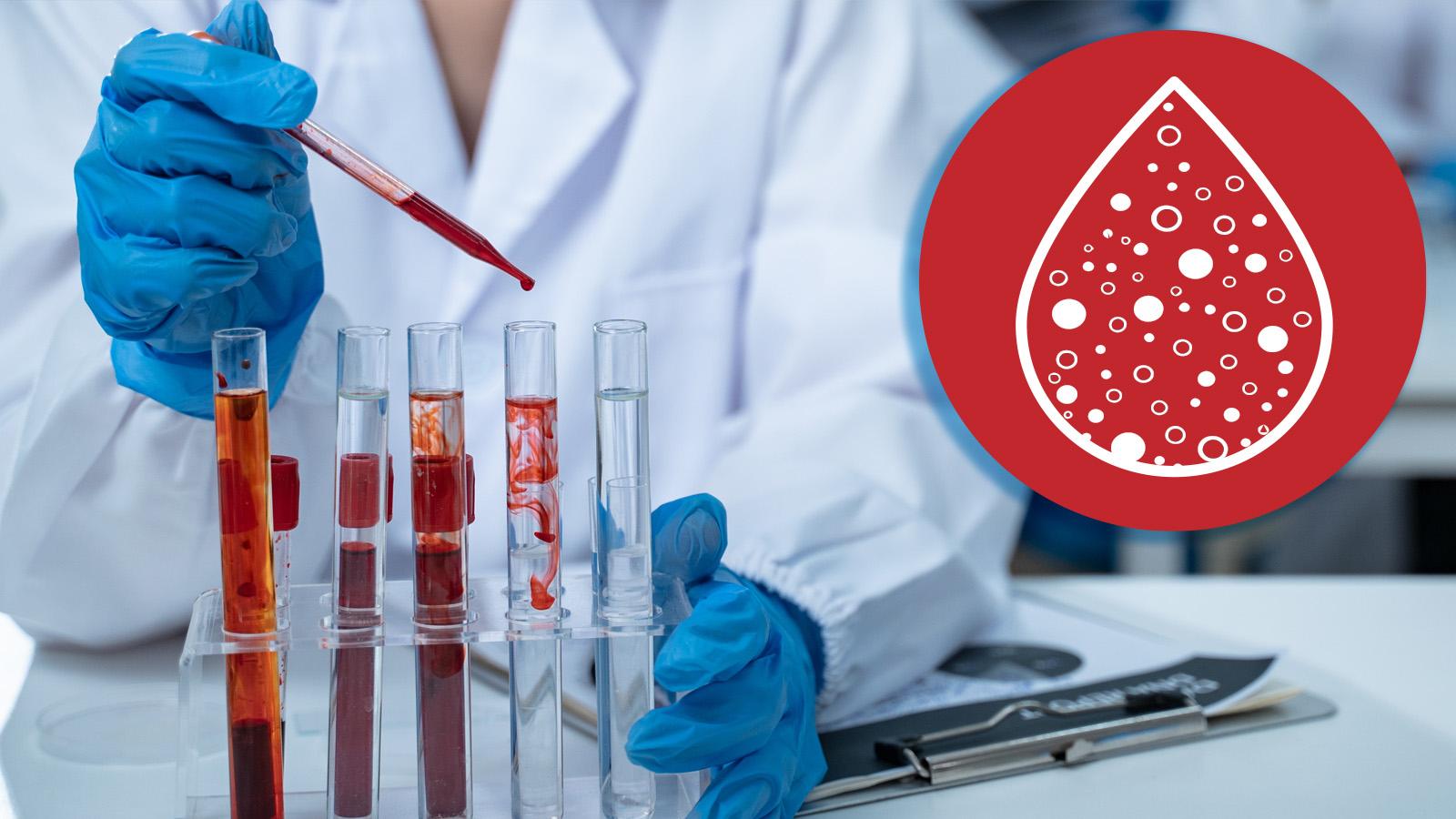 Blutuntersuchung im Labor: Blutgase