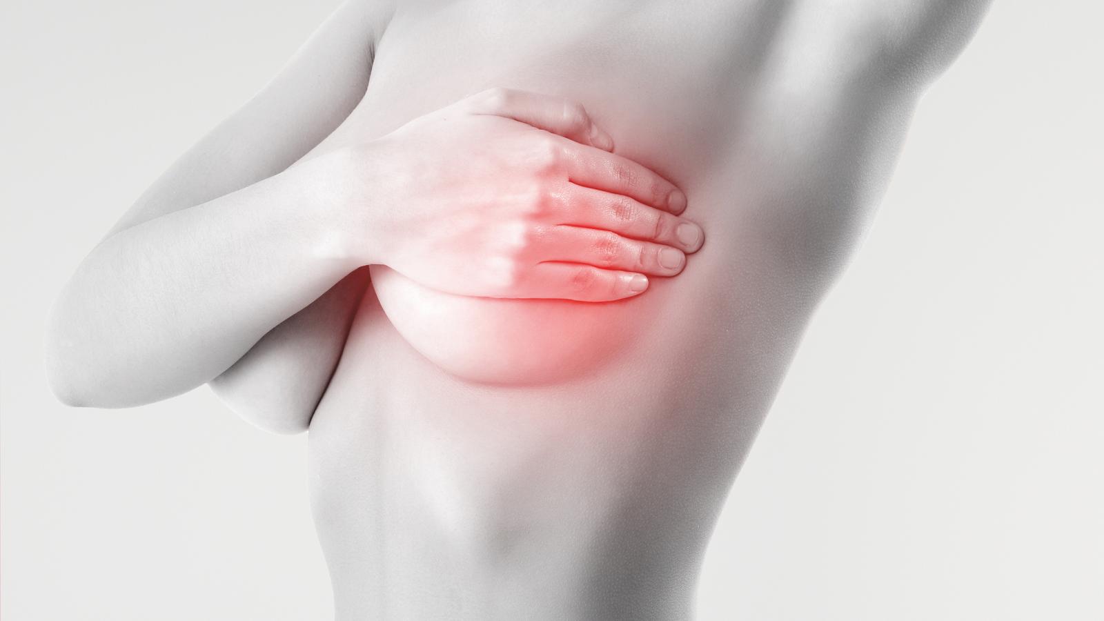 Brustkrebserkennung – neue Technologien in der Diagnose Frau hält sich ihre Brust
