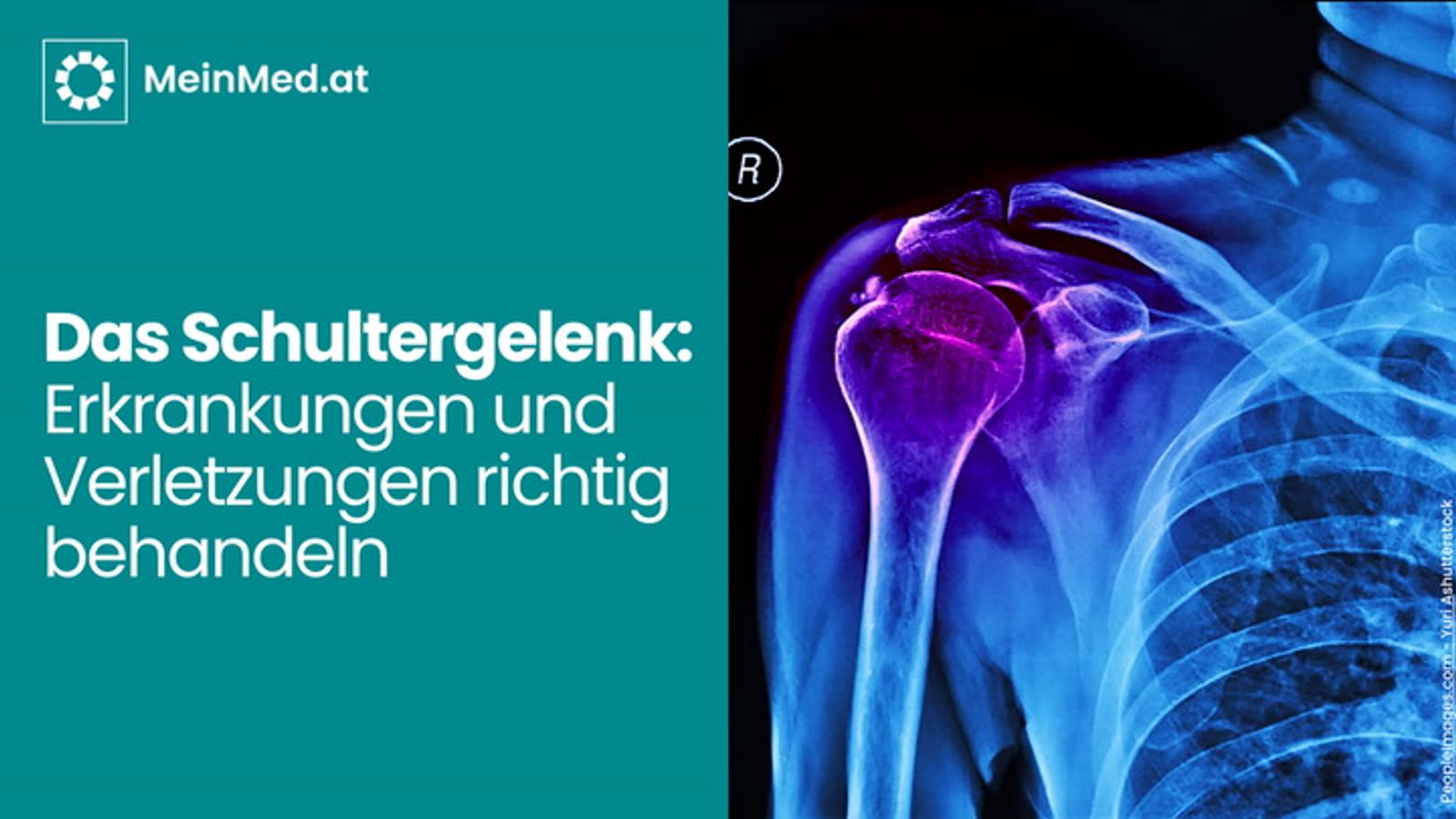 Das Schultergelenk: Erkrankungen und Verletzungen richtig behandeln