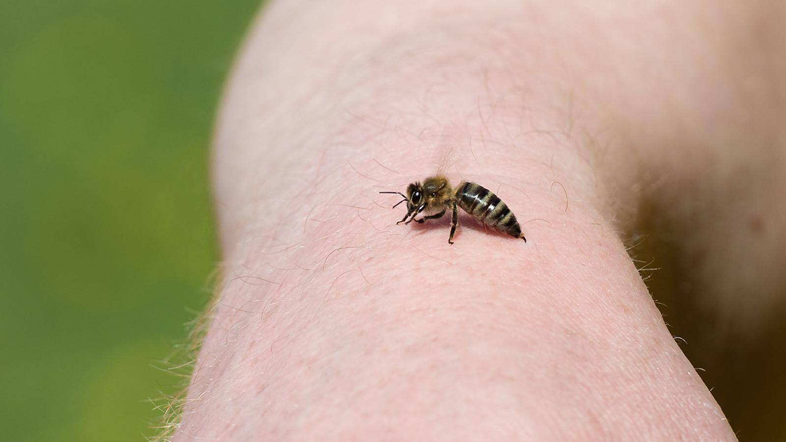 Hausmittel gegen juckende Bienenstiche