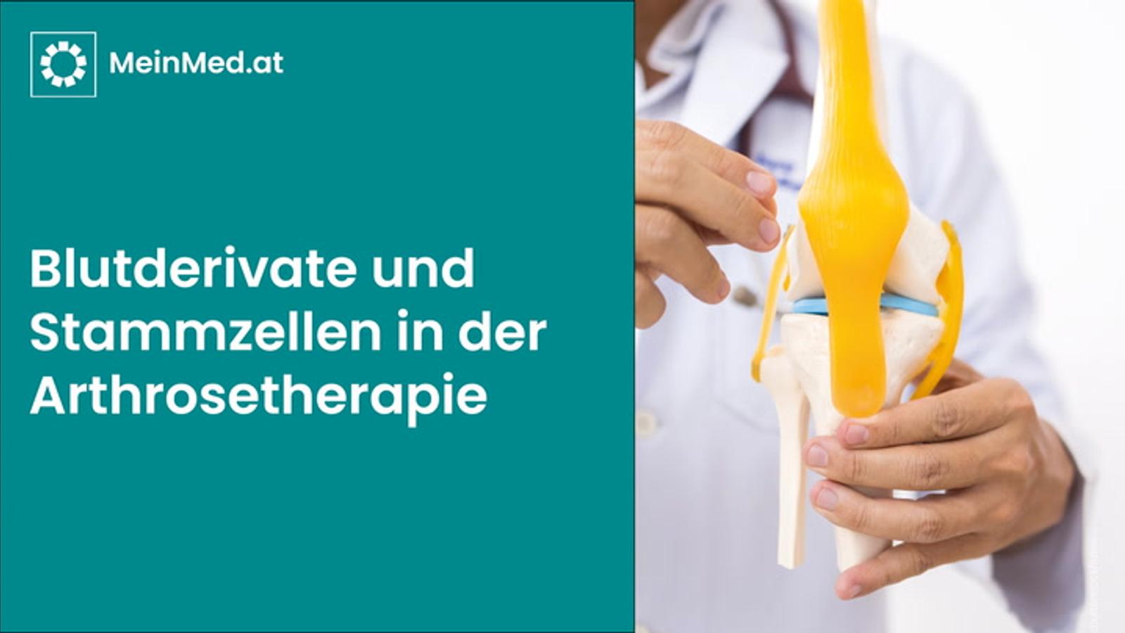 Blutderivate und Stammzellen in der Arthrosetherapie