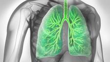 Darstellung eines Lunge