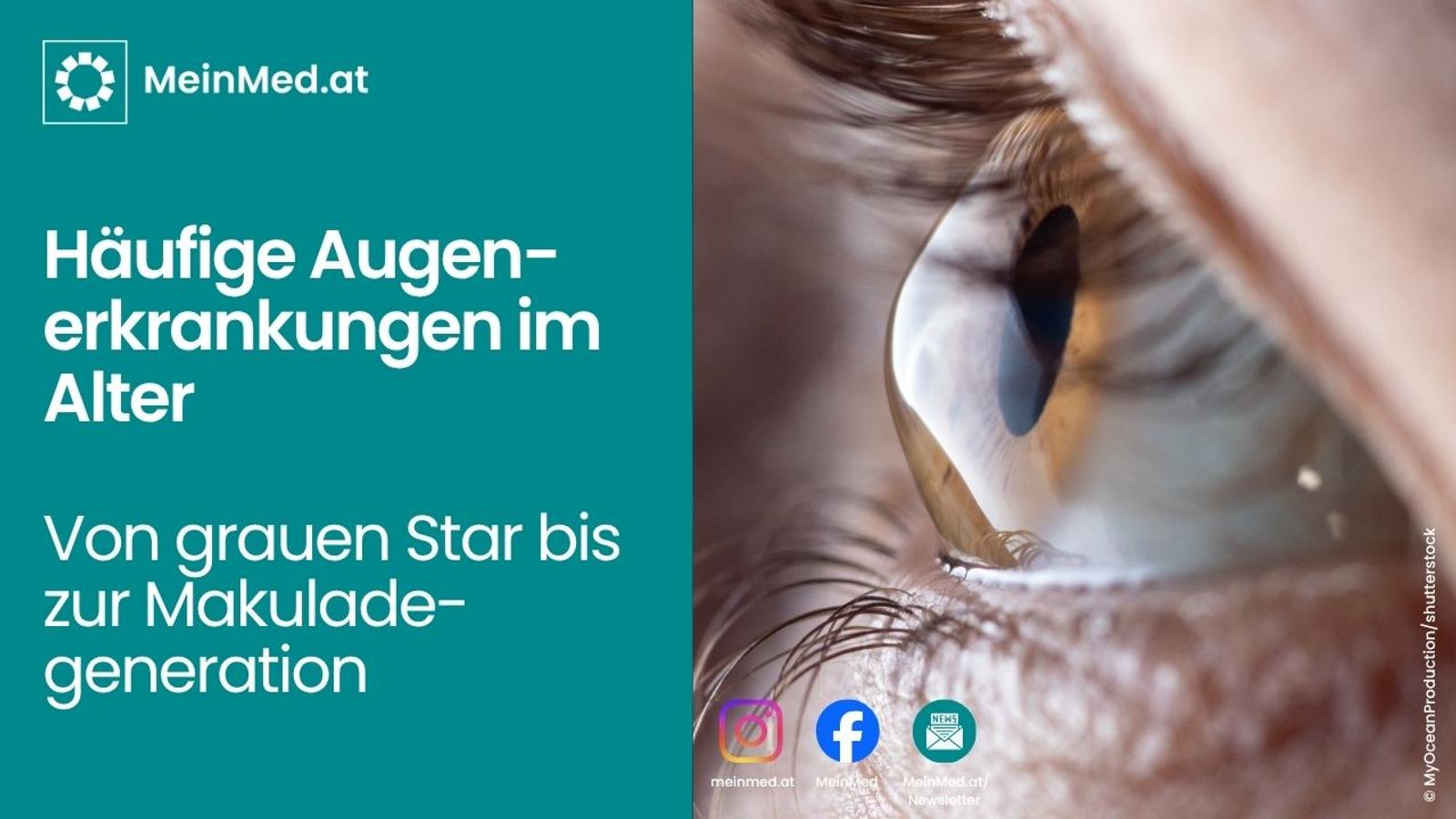 Die häufigsten Augenerkrankungen im Alter