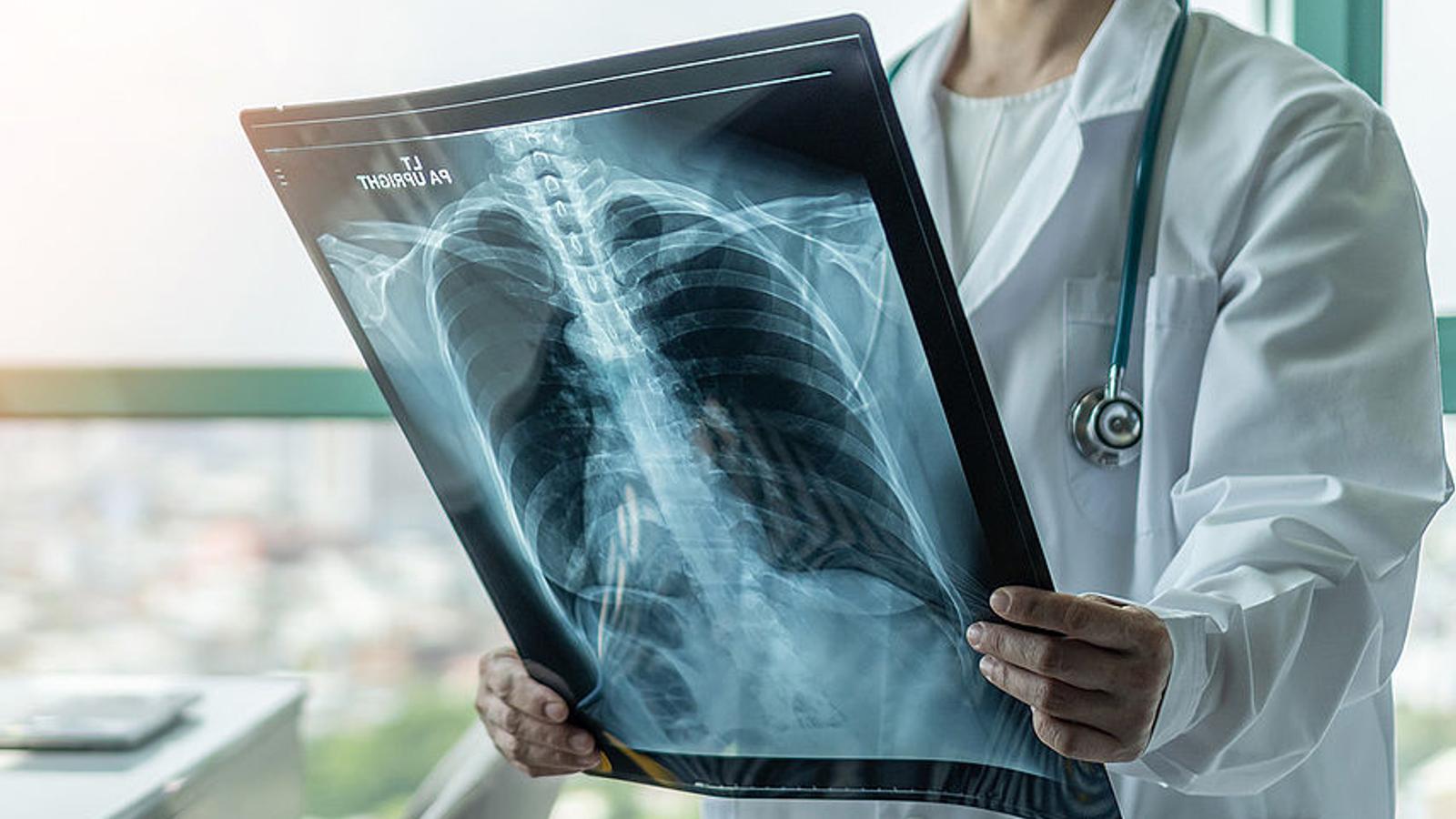 Ärztin sieht Röntgenbild von Menschen mit Lungenödem