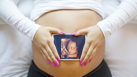 Frau hält Ultraschallbild ihres Babys vor dem Bauch