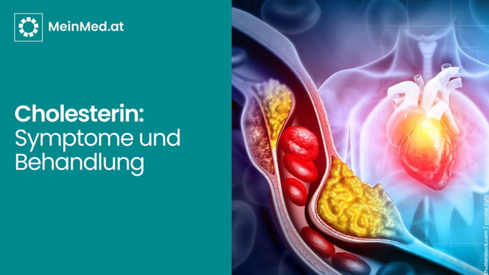 Cholesterin: Symptome und Behandlung