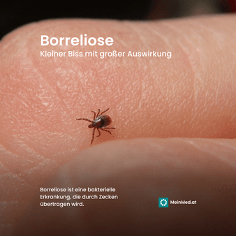 Borreliose