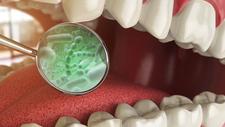 Abbildung von Bakterien im Mund