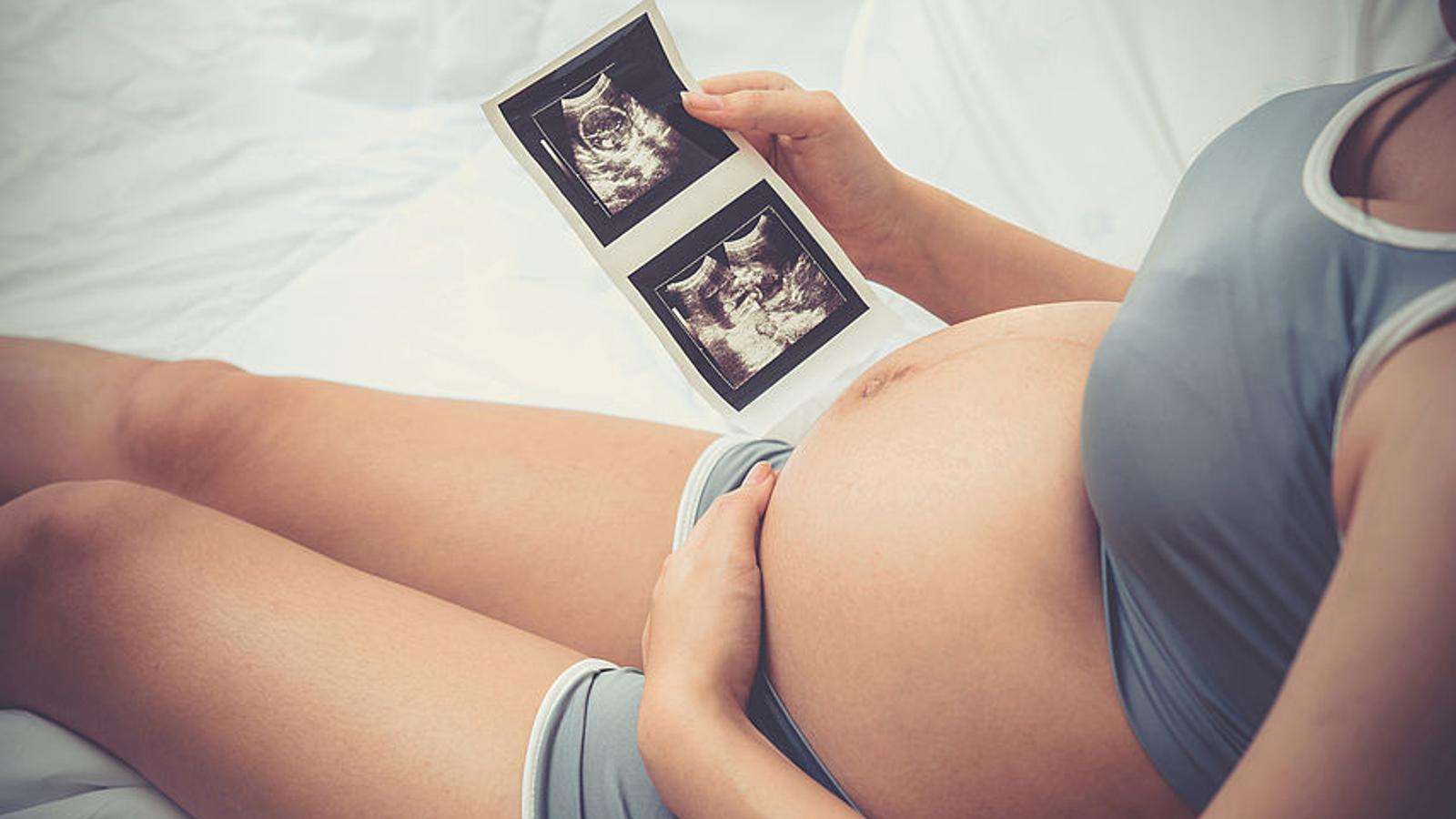 Schwangere Frau hält Ultraschallbild ihres Babys in der Hand. 