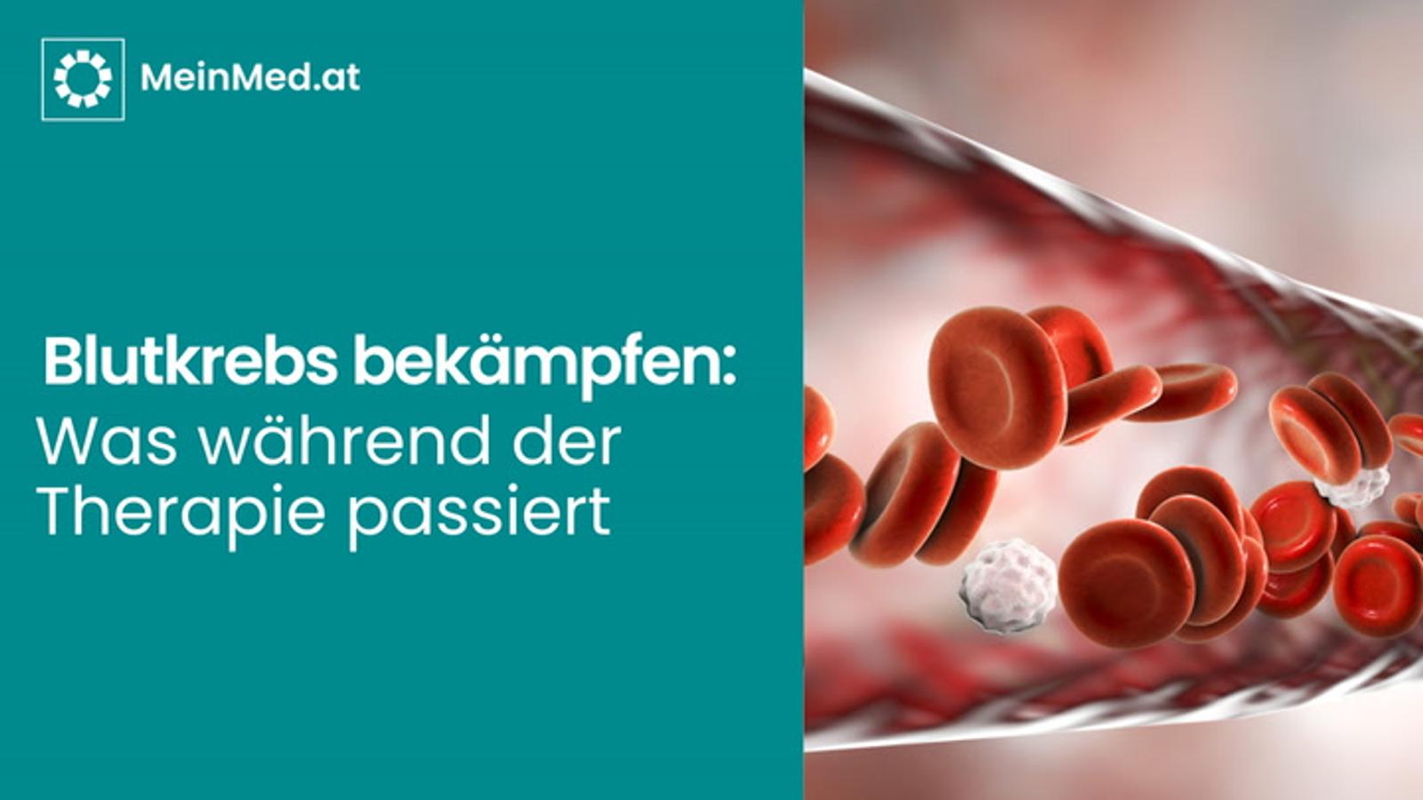 Blutkrebs bekämpfen: Was während der Therapie passiert