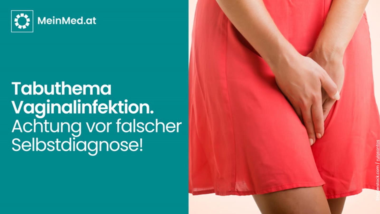 Tabuthema Vaginalinfektion. Achtung vor falscher Selbstdiagnose!