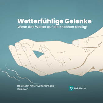 Wetterfühlige Gelenke