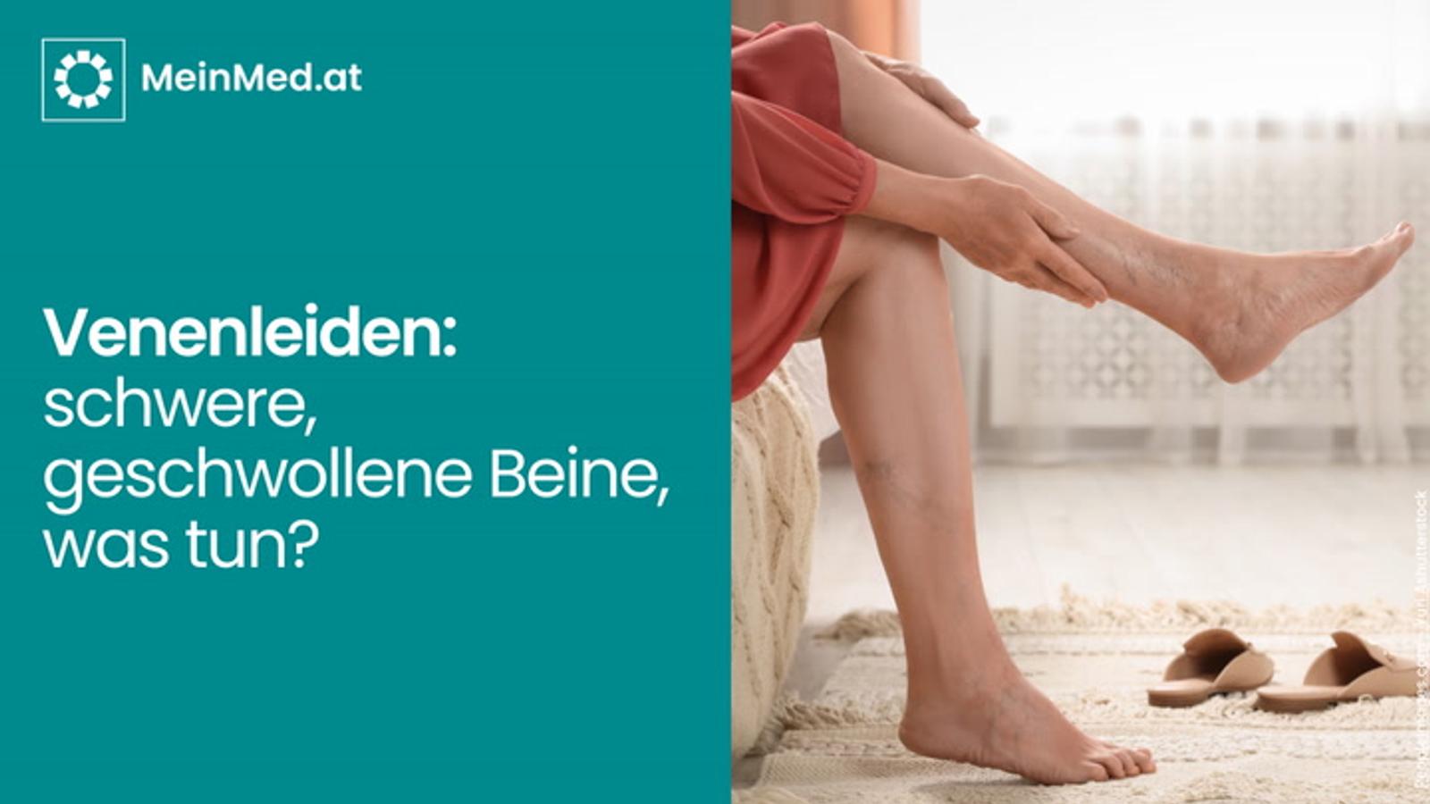 Venenleiden - schwere, geschwollene Beine, was tun?