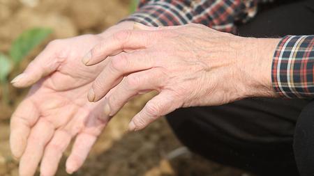Mann mit Morbus Parkinson