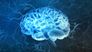 Neurologische Erkrankungen - präzise Diagnosen ermöglichen präzise Behandlungen: Beispiele neurologischer Entwicklungen der letzten 25 Jahre
