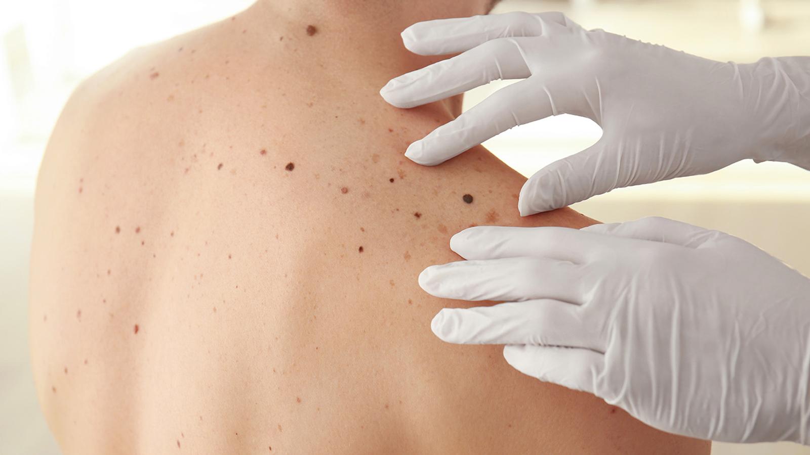 Dermatologie