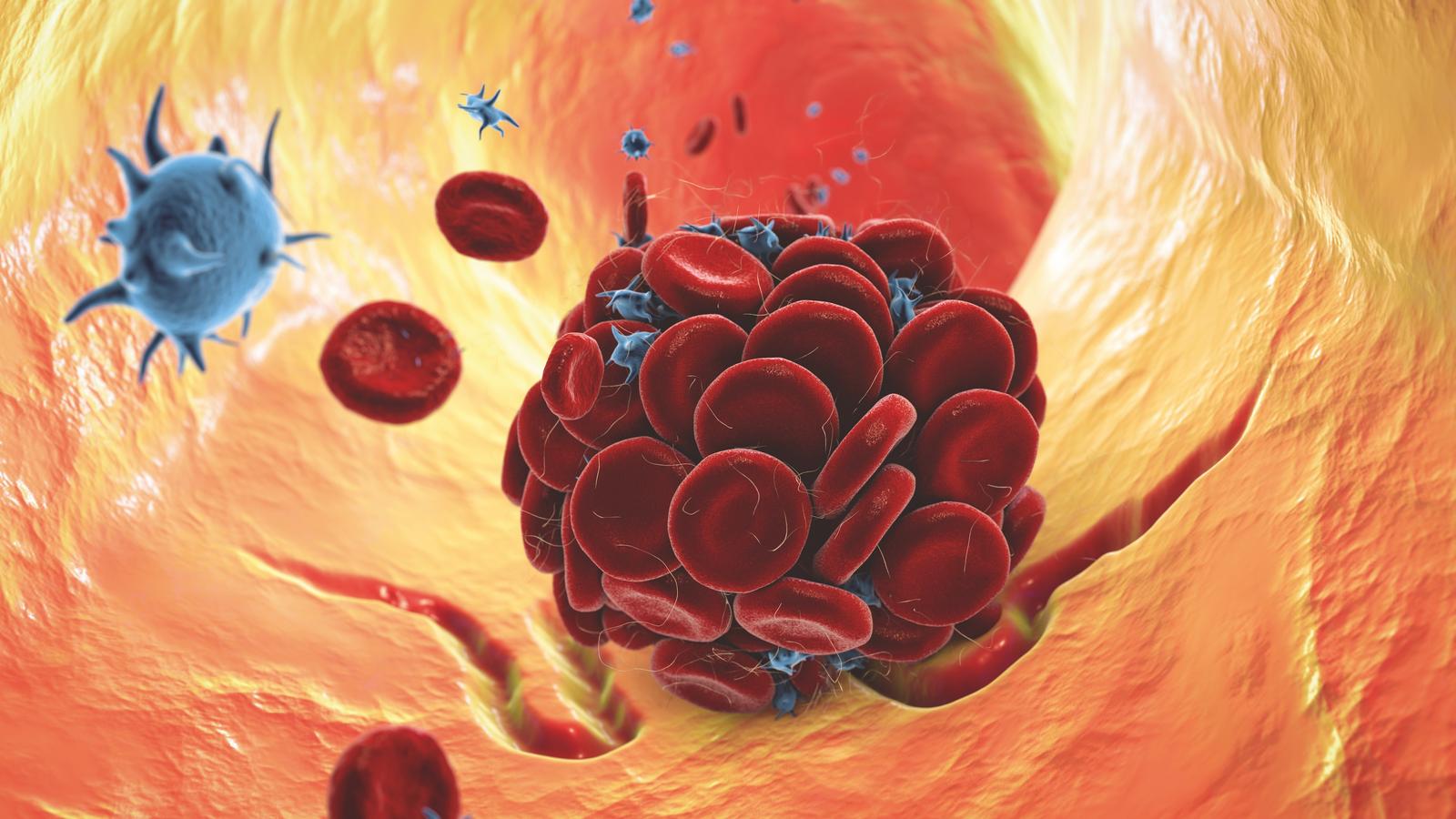 Thromboseplättchen lösen sich in BLutbahn