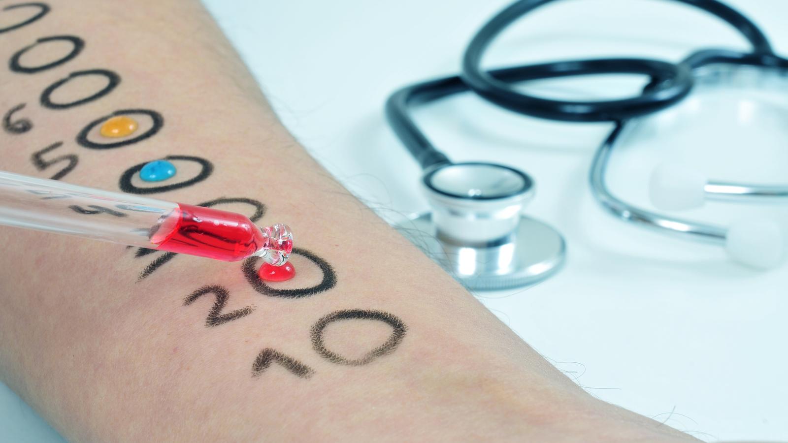 Evidenzbasierte Verordnung in der Allergologie Evidenzbasierte Verordnung in der Allergologie