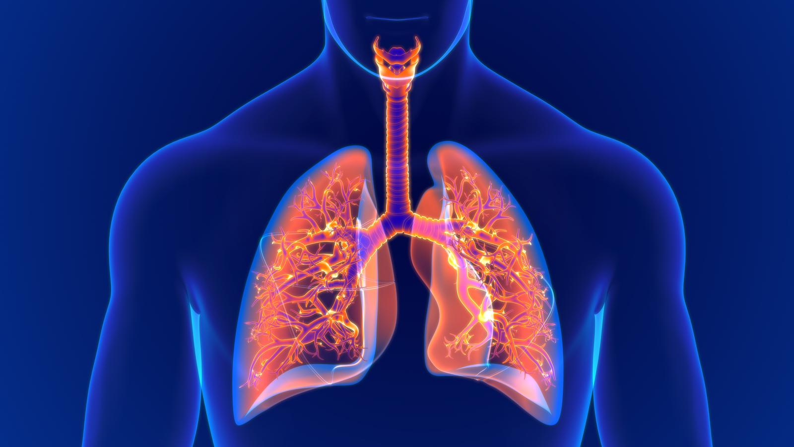 Lunge im Röntgen