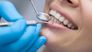 Zahngesundheit: Lächelnd durchs Leben gehen