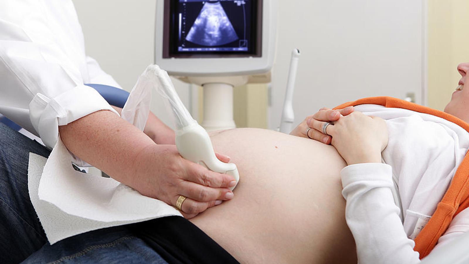 Bei einer schwangeren Frau wird eine Ultraschalluntersuchung durchgeführt. 