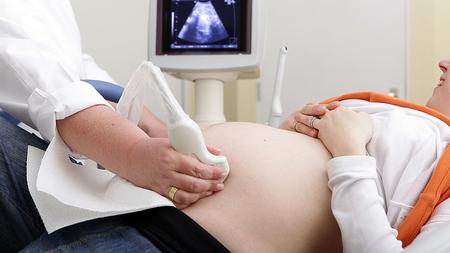 Bei einer schwangeren Frau wird eine Ultraschalluntersuchung durchgeführt. 