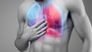 Chronische Lungenerkrankungen: idiopathische Lungenfibrose, Asthma und COPD im Fokus 