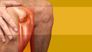 Was gibt es Neues in der Arthrosetherapie?