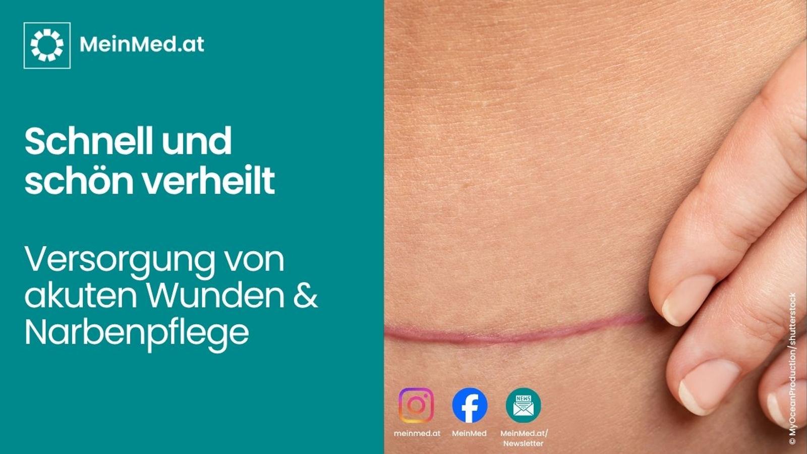 Schnell und schön verheilt: Wundversorgung & Narbenpflege