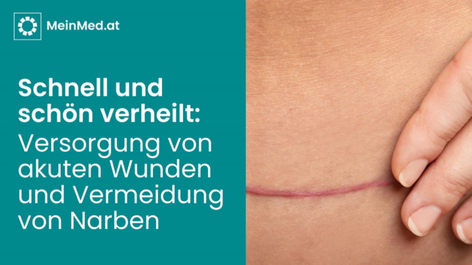 Schnell und schön verheilt: Versorgung von akuten Wunden und Vermeidung von Narben