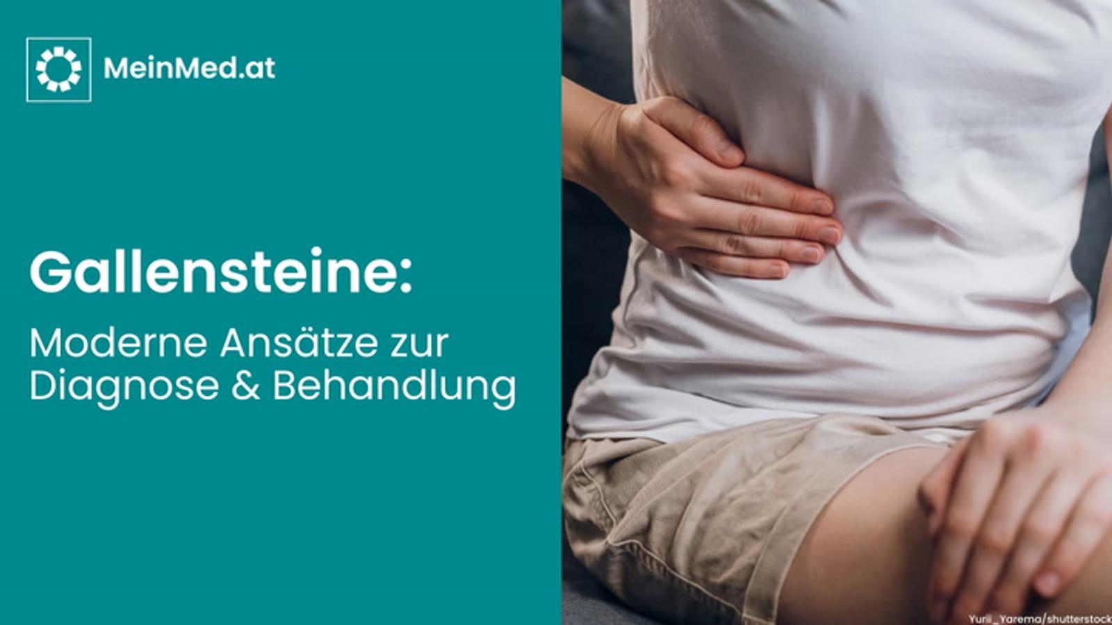 Steine im System: Moderne Ansätze zur Diagnose und Behandlung von Gallensteinen