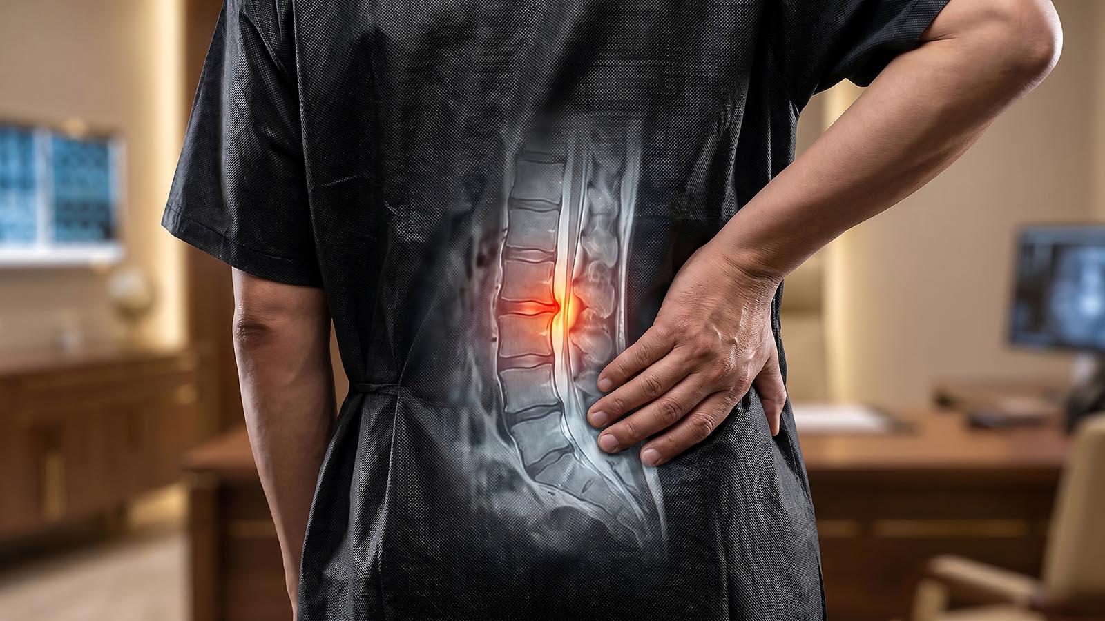 Nahaufnahme einer lumbalen Spinalstenose, Rücken eines Menschen mit transparenter anatomischen Überlagerung der Wirbelsäule