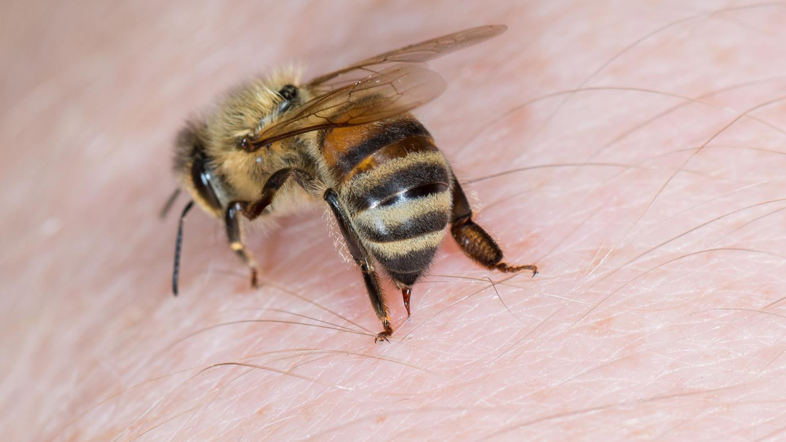 Biene sticht Insektengiftallergiker: Lebensgefahr