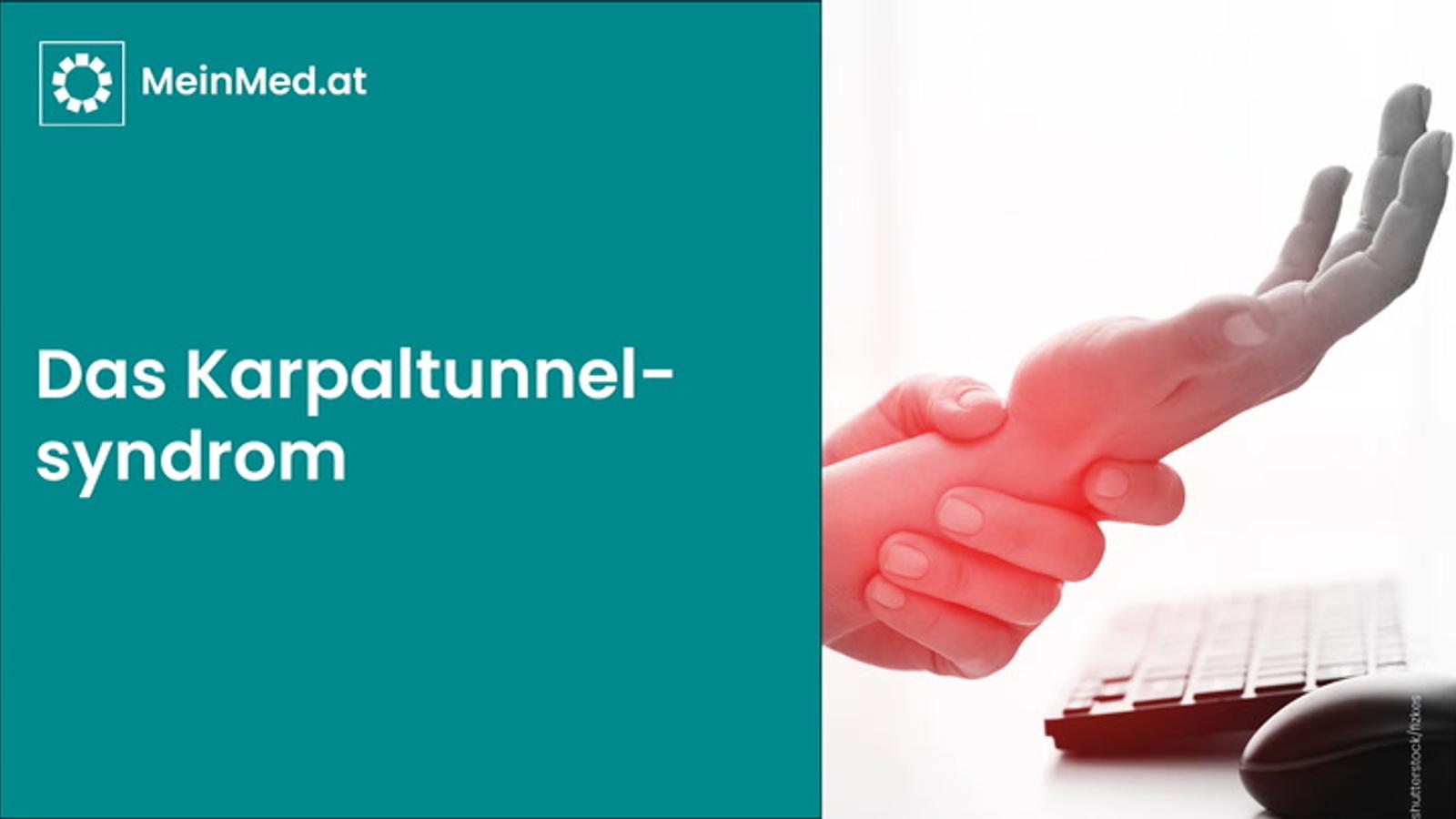 Das Karpaltunnelsyndrom