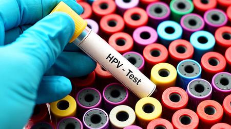 Blutabnahmeröhrchen für HPV Test