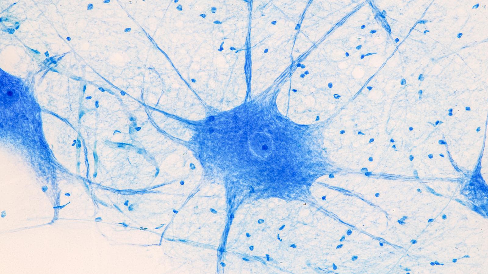 Neurologische Erkrankungen