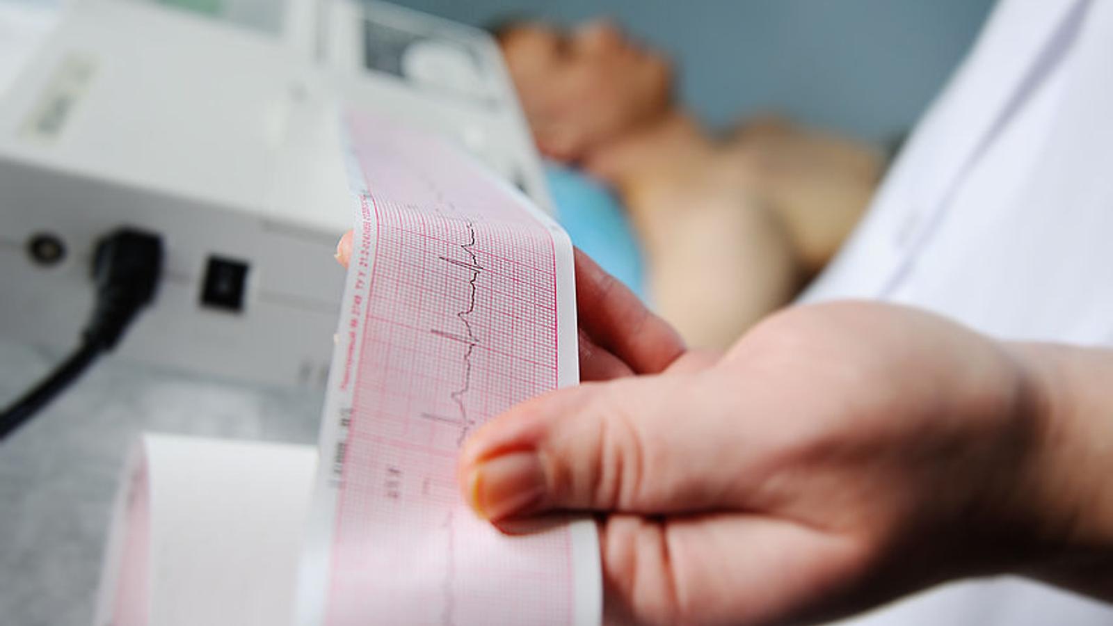 Bei einem Patient wird ein EKG durchgeführt. 