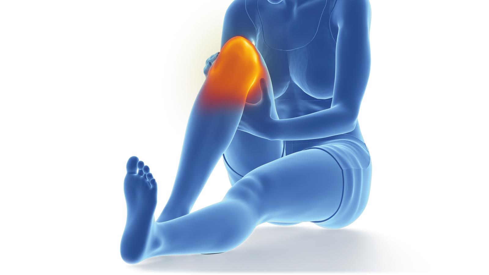 Grafik von Frau mit entzundenem Knie