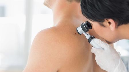 Hautärztin untersucht Patienten mit der Auflichtmikroskopie