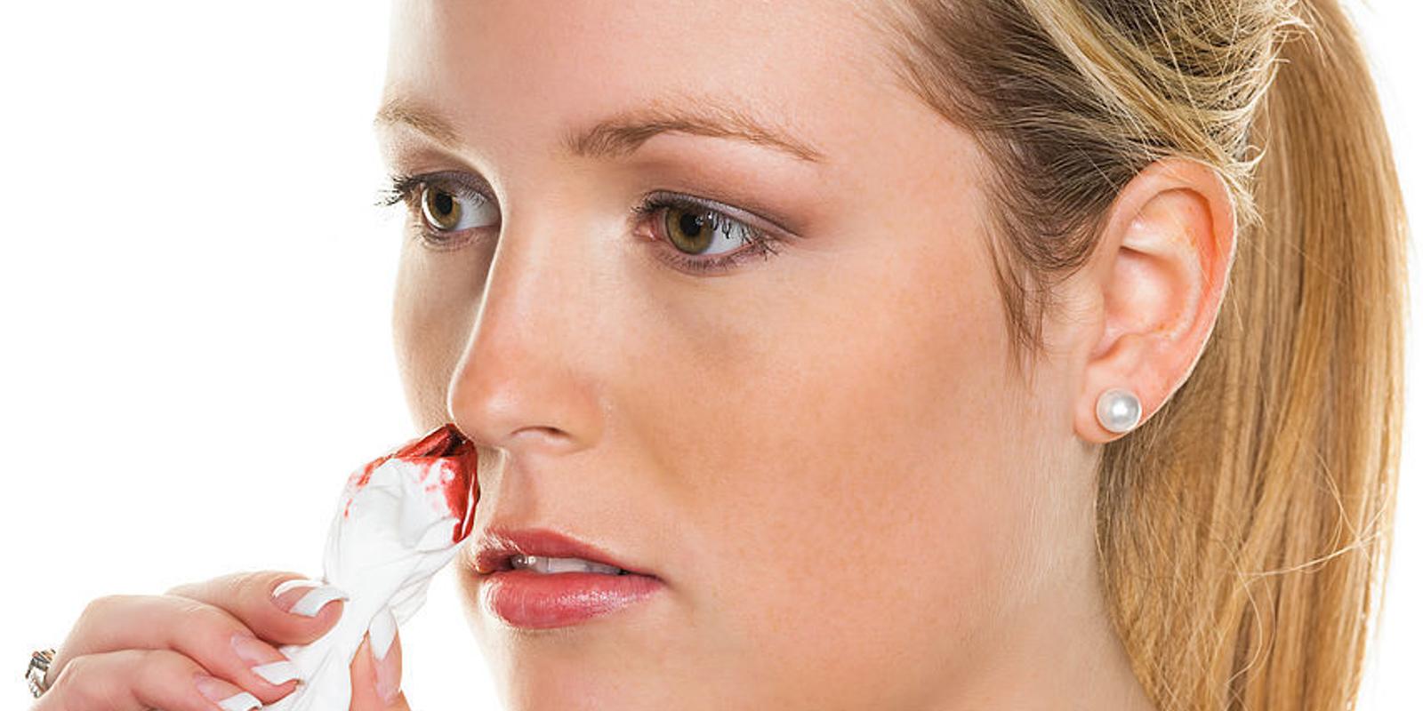 Nasenbluten: was tun? » Ursachen und Erste Hilfe